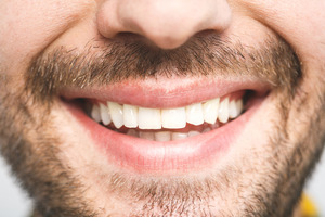 Close-up of a bearded man’s smile