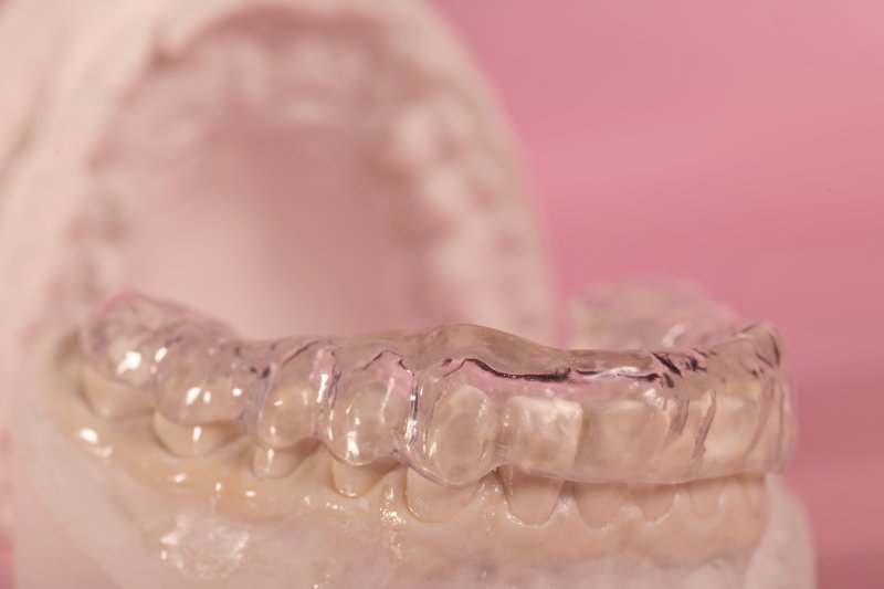 Oral appliance on model teeth